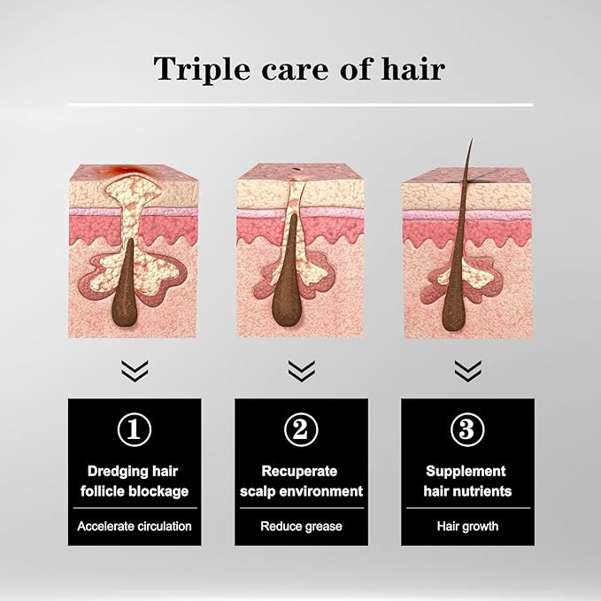 5% Minoxidil Hair Liquid for Men & Women, 2 x 3ml, with Ginseng & Ginger Root Extract - Hair Growth Supporting Treatment for Thinning Hair, Scalp Care Serum to Help Reduce Hair Loss Appearance
