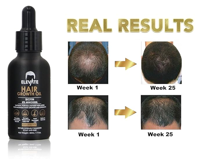 Elevate Hair Regrowth Treatment 5% Minoxidil Solution - Biotin Serum Hair Growth Oil for Men & Women - Thicker Fuller Stronger Hair - Stops Hair Loss & Thinning - Natural Hair Thickening Treatment 1oz