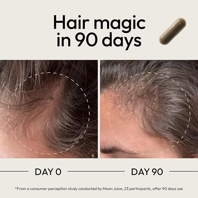 Moon Juice SuperHair Hair Growth Vitamins for Women & Men with Biotin & Saw Palmetto - Clinical Strength Multivitamin Hair Supplement for Healthier, Stronger, Thicker Hair, 120 Capsules - 30 Servings
