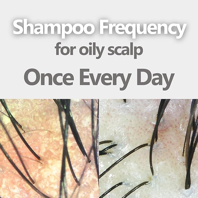 Aromase Oily Scalp Balancing Shampoo (Ideal for oily scalp with dandruff) 14 FL OZ