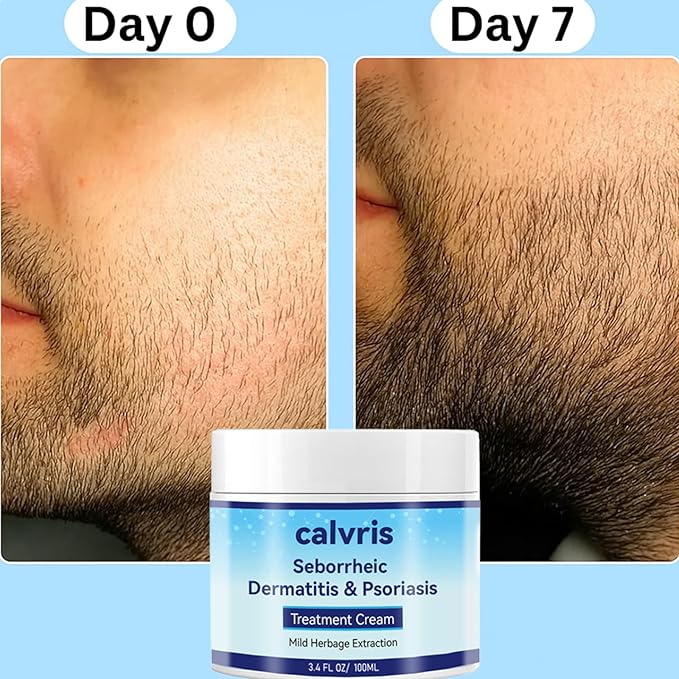 Scalp Comfort Balm - Steroid-Free Botanical Formula for Dry, Itchy Scalp & Skin, 3.4 Fl Oz | Natural Soothing Relief with Cooling Sensation