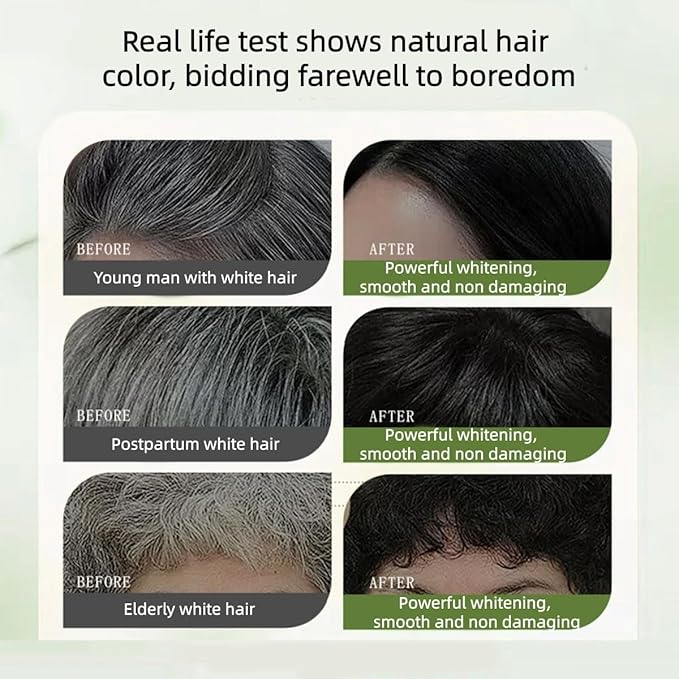 Long-Lasting Botanical Essential Oil Hair Dye,Mild Formula Long Lasting Hair Dye Set,Plant-Based Hair Color for Gray Coverage (Brown)