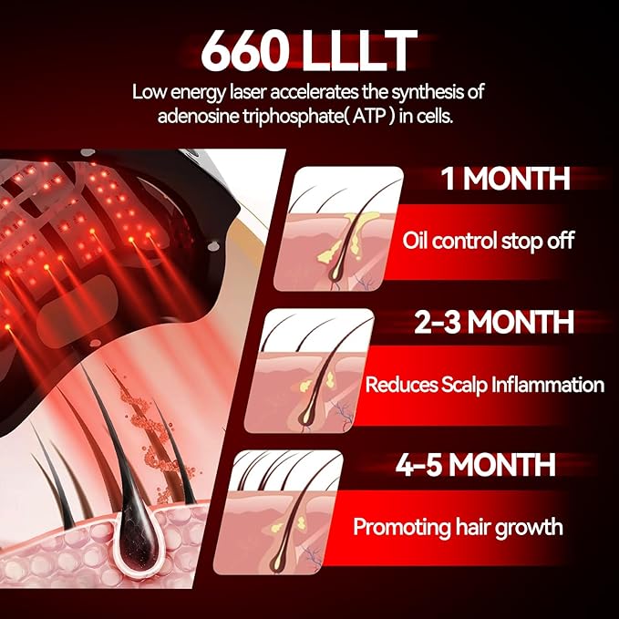 Red Light Therapy for Hair Growth, Laser Cap Red Light Higher Dose for Hair Regrowth FDA Cleared for Hair Loss Treatment LLLT Hair Thinning & Alopecia for Men Women