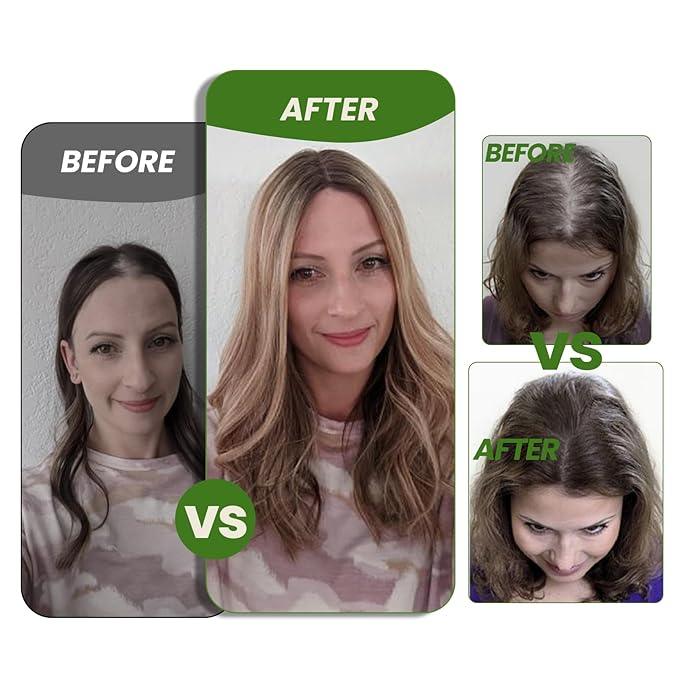 HAIR Real Human Hair Toppers for Women 150 Density 6x7inch Hand-Tied 65 grams 14 inch Hair medium dark brown for Women with Thinning Crown (#4 14inch)