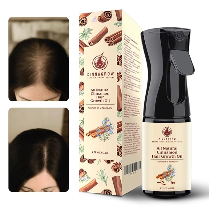 Hair Growth Oil with Rosemary & Cinnamon – Thicker Hair, Scalp Nourishment & Strength – Lightweight, Non-Greasy, Fast Absorbing Formula – 60 ml (2 fl oz) Bottle with Pump Dispenser