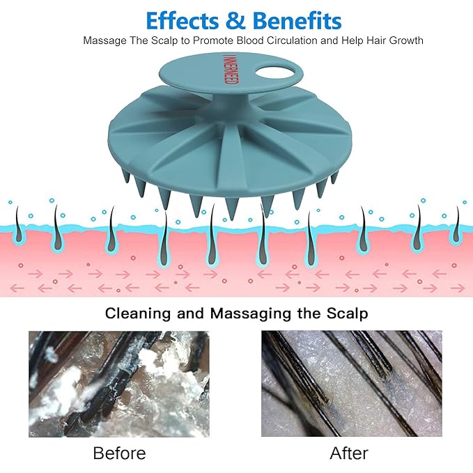 Scalp Massager Shampoo Brush, Wet & Dry Manual Scalp Care Head Scrubber Hair Washing, Soft Silicone Bristles, for Hair Growth, Dandruff Removal, Comfortable for All Hair Types (Dark Green+Gray)