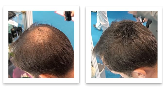 Hair Building Fiber. Cover Bald Spot and Thinning Hair Instantly. 10X Fuller Hair. All-Natural, Organic Hair Loss Concealer. Trial Size (10-Day Supply). Medium Brown