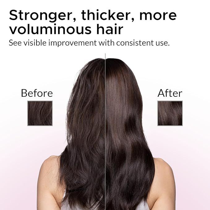 Women’s 2% Minoxidil Hair Regrowth Shampoo – Biotin, Caffeine & DHT Blockers for Thicker-Looking Hair – Strengthening Formula with Keratin, Castor Oil, Green Tea & Rosemary 12.17 fl oz