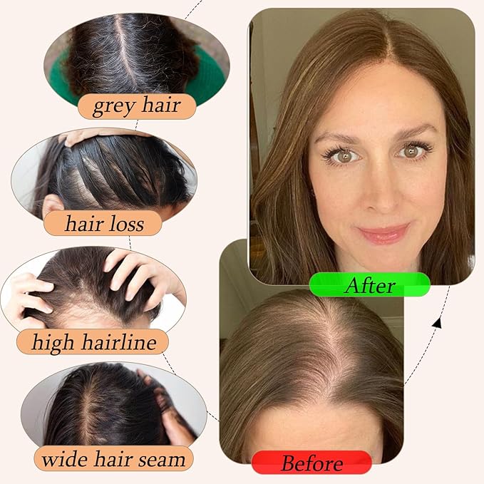Human Hair Toppers for Women with Thinning Hair Real Human Topper Crown No Bangs 10 Inch #4 Medium Brown