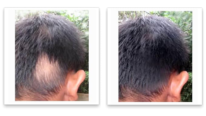 Caboki Root Touch Up Powder: Fill in Thinning Hair, Hairline & Edges, Cover Bald Spots & Gray Hair - TALC-Free, Volumizing Hair Fiber for Men & Women in Salt & Pepper and Dark Shades