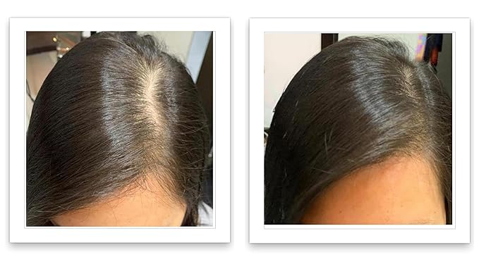 Caboki Healthful Powder Volumizer for Men & Women: Thinning Hair Solution for Root Touch Up, Hairline & Edges, Covering Hair Loss, Bald Spots & Gray Hair - TALC-Free,