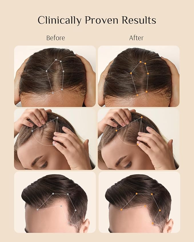 DR ZERO REDENICAL Hair Growth Conditioner for Women, 13.5 oz, Volumizing Thickening & Anti Hair Loss Regrowth Treatment, Clinically Tested for Hair Thinning with Redensyl, Japanese Hair Care Products