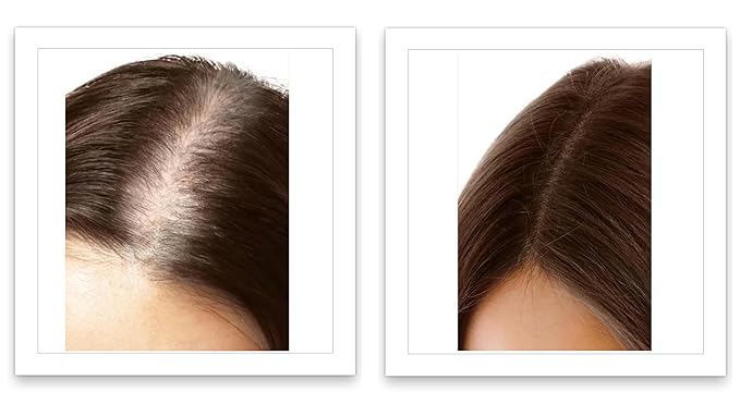 Caboki 10X Hair Volumizer for Thinning Hair: Root Touch Up, Fill in Hairline & Edges, Cover Bald Spots and Gray. TALC-Free, Healthful Powder for Men and Women. Light Auburn