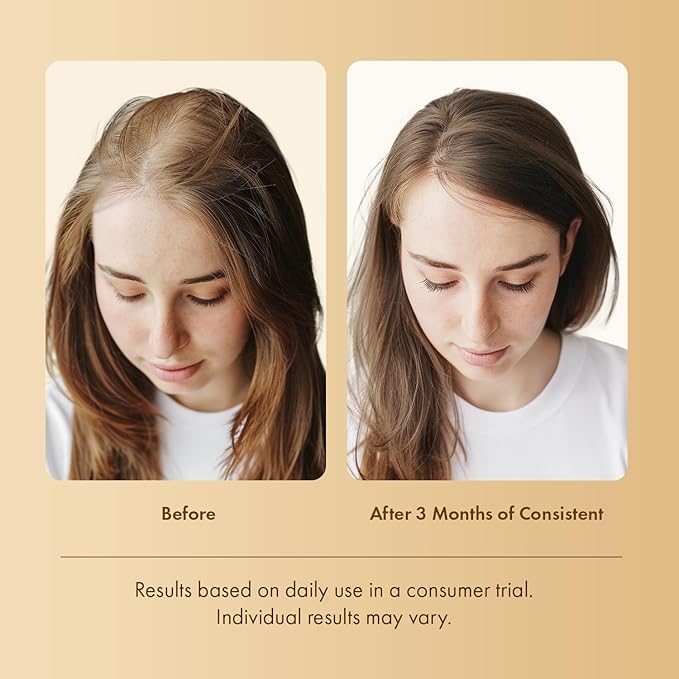 Hair Growth Serum Scalp Treatment: Scalp Serum with Rosemary, Multi-Peptide & Caffeine for Anti Hair Loss and Thinning - Thickening and Density for Women & Men