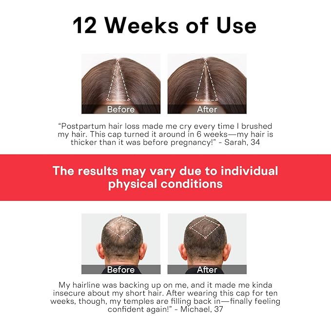 Red Light Therapy for Hair Growth,Infrared Red Light Hair Therapy Hat,Laser Hair Growth Cap Detachable,Support for Men & Women
