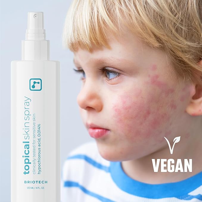 BRIOTECH Topical Skin Spray, Hypochlorous Acid Spray for Sensitive Skin, HOCl Facial Mist, Full Body Support Against Irritation, Calm Redness, Soothe Foot & Scalp, 2 oz Travel Size (2 Pack)