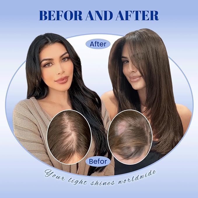 WORLDSTAR Hair Toppers for Women Real Human Hair 6 * 7 Inch Base 14Inch 65g #1B/4/27 Natural Black Ombre Brown with Caramel Blonde Hair Topper for Women with Thinning or Grey Roots (tp#1B/4/27-14)