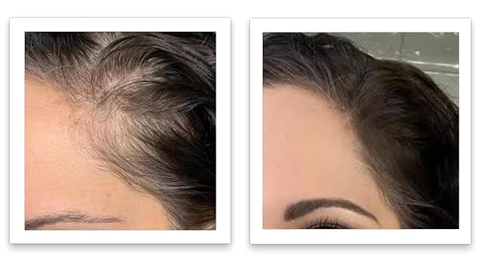 Caboki 10X Hair Volumizer for Thinning Hair: Root Touch Up, Fill in Hairline & Edges, Cover Bald Spots and Gray. TALC-Free, Healthful Powder for Men and Women. Light Auburn