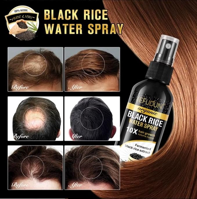 Organic Black Rice Water Spray for Hair Growth, with Castor Oil & Ginger Root Extract for Thicker, Fuller Hair, Helps in Hair Loss and helps Repair Damage 100ml/3.2 fl. Oz (1 PC) - ActivePur