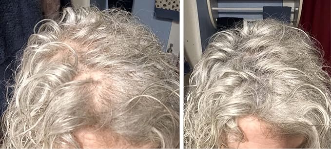 Hair Loss Concealer. Covers Bald Spot And Makes Thin Hair Look 10X Fuller Instantly. All-Natural Hair Building Fiber. Trial Size, 10-Day Supply. Gray