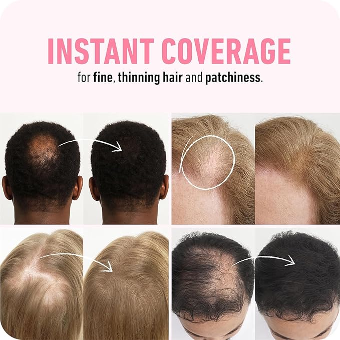BOLDIFY Hair Fibers (56g) - Fill In Thinning and Fine Hair for an Instantly Fuller, Thicker Look - 14 Shades for Women & Men - Black