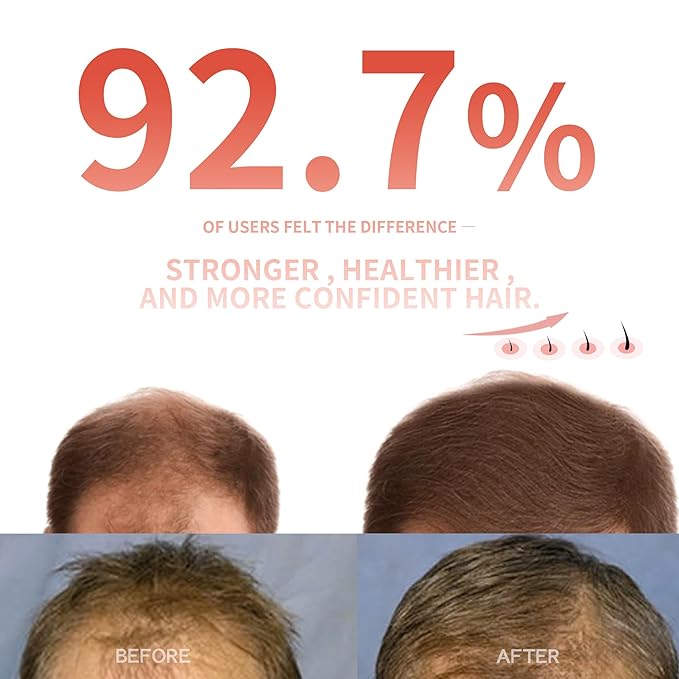 Instyle Egg 272 Pro Max DualWave Laser Cap for Hair Regrowth | Laser Hair Growth Device | Red Light Therapy, Hair Loss Treatment for Men and Women