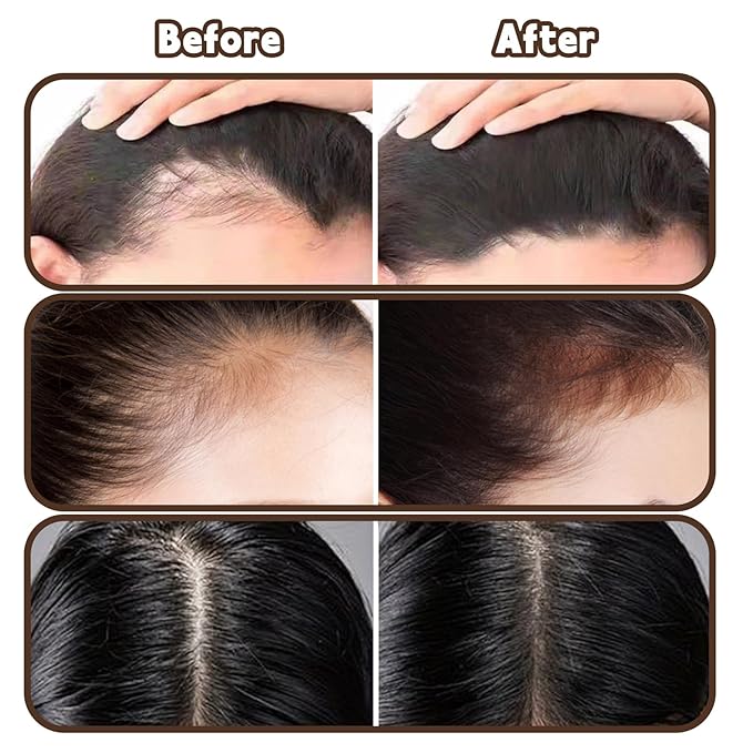 Root Touch Up Powder Hair Color Dark Brown, Root Cover Up Hair Powder for Women Scalp Concealer, HairlinePowder for Women GrayHair
