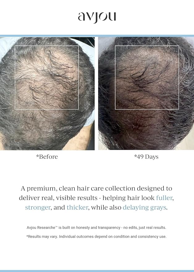 Avjou Researche™ Scalp Serum – Thicker, Fuller-Looking Hair + Targets Visible Signs of Premature Greying – 3 Patented Ingredients – Backed by Cosmetic Science – Oil-Free, All Hair Types, 1.7 oz