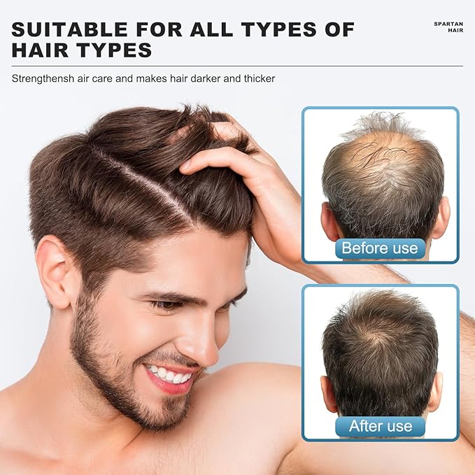 Root Activator Shampoo for Men- Strengthening & Smoothing System for Thinning and Gray Hair - Adds Volume & Nourishes Strands - Men & Women