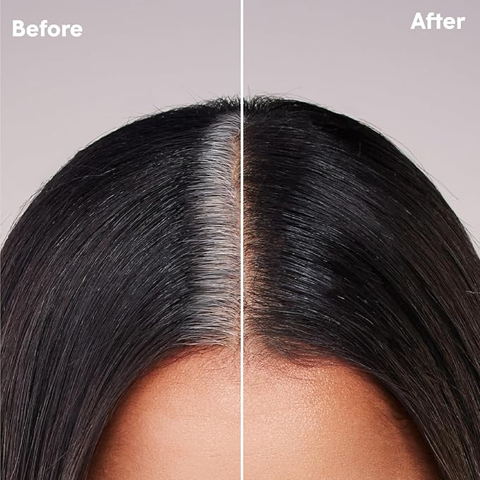 dpHUE Root Touch-Up Kit for Resistant Grays, Dark Brown - Permanently Cover Difficult, Stubborn Gray Hair - 2 Applications Included - Vegan & Leaping Bunny Certified