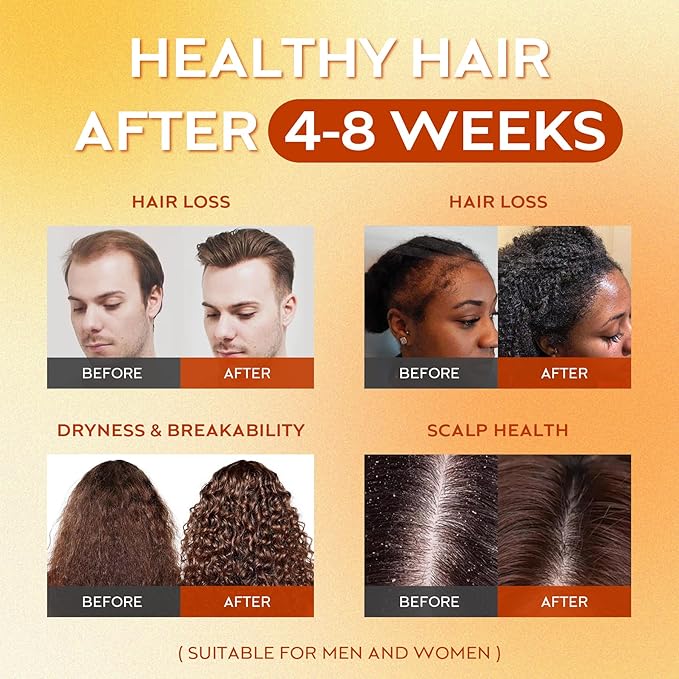 Batana Oil for Hair Growth Dr Sebi, 100% Raw Organic Batana Hair Mask from Honduras, Wild Growth Hair Oil, Scalp Oil Promotes Hair Thickness, Prevents Loss for Men & Women, 4.06 fl oz