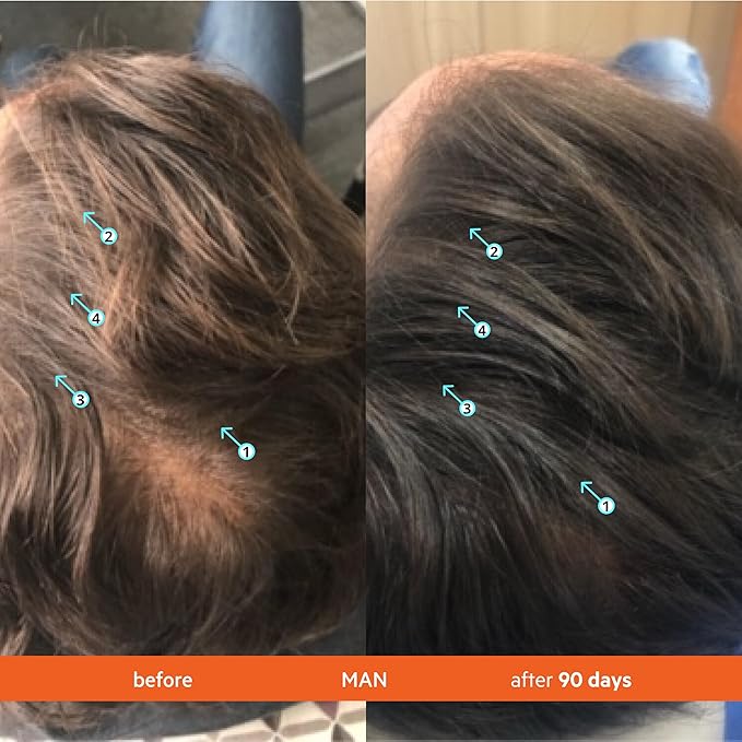 DS Labs Revita Shampoo & Spectral Men’s Serum Kit – Scalp First Cleanse & Lightweight Leave-In for Fuller Looking, Thicker Looking Hair, Sulfate & Silicone Free Shampoo, Fast Absorbing Serum