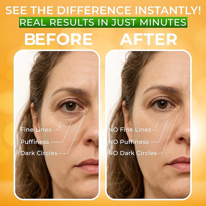 Puffy Eye Treatment Instant results – Naturally Eliminate Wrinkles, Puffiness, Dark Circle and Bags in Minutes – Hydrating Eye Cream w/ Green Tea Extract, Dead Sea Minerals by SEAMANTIKA – .8 fl.oz.