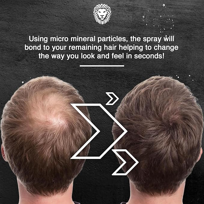 Mane Hair Thickening Spray & Root Touch Up, Seal & Control Combo Pack, Instantly Thicker Hair for Men & Women, Fill in Hairlines and Hide Thinning and Fine Patches - Auburn, 12 Colors (6.76 oz)