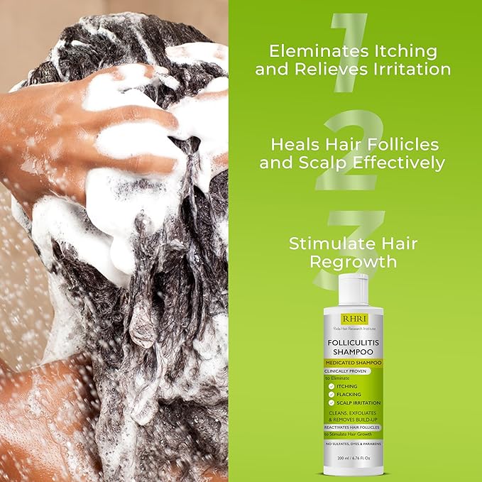 Anti Fungal Shampoo for Folliculitis, Seborrheic Dermatitis, Dandruff, Scalp Psoriasis & Itchy Dry Scalp Relief