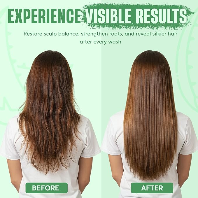 Aloe Vera Shampoo and Conditioner Set | 16 fl oz Each | with Batana Oil | Hydrating, Soothing & Moisture Balance Formula | Nourishing Care for Dry, Itchy or Sensitive Scalp