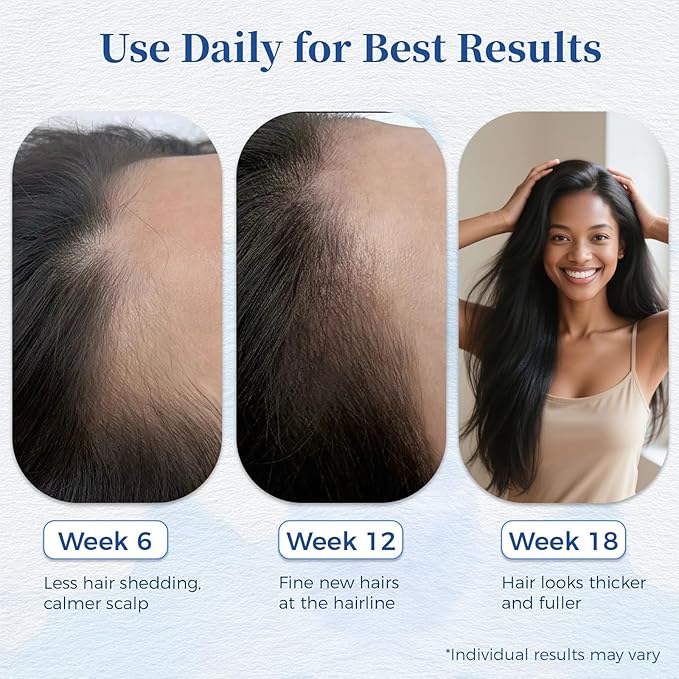 Hair Growth Serum Roll On with Rosemary，Helps Support Thicker, Fuller Hair Appearance，Clean, Non-Greasy Hair Loss Support for Men & Women，Saw Palmetto，0.84 Fl Oz (Pack of 1)