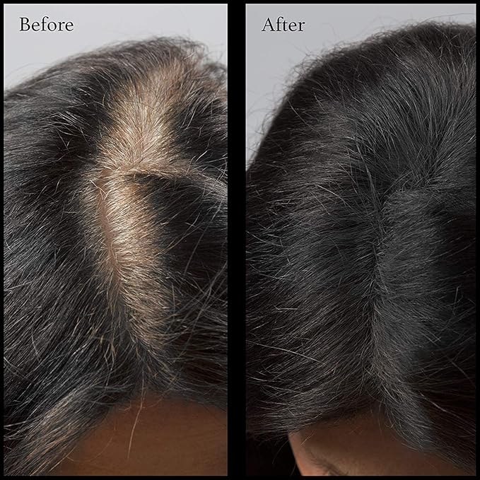 Root Touch Up Powder - 11 True-to-Nature Hairline Concealer Shades - No Fragrance, Talc or Parabens - Hair Cover by NuBeauti (Without Brush, Black)