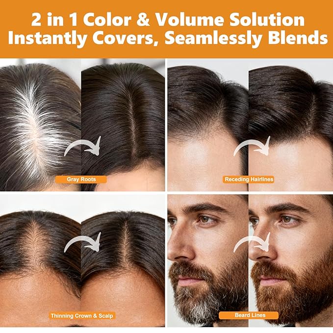 Root Touch Up Hair Color Spray–4oz, Sweat-Resistant & Natural, Instant Gray Hair Cover Up, Temporary Root Concealer Hair Filler Dye Spray for Hairline, Scalp&Thinning– Dark Brown – Women & Men
