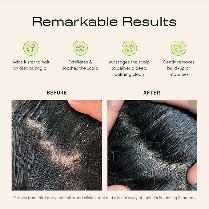 Jupiter Scalp Exfoliator - Scalp Massager Tool for Wet & Dry Hair - Ergonomic Detangler Brush - Dandruff Comb & Scrub to Remove Dandruff & Buildup and Support Circulation - Black