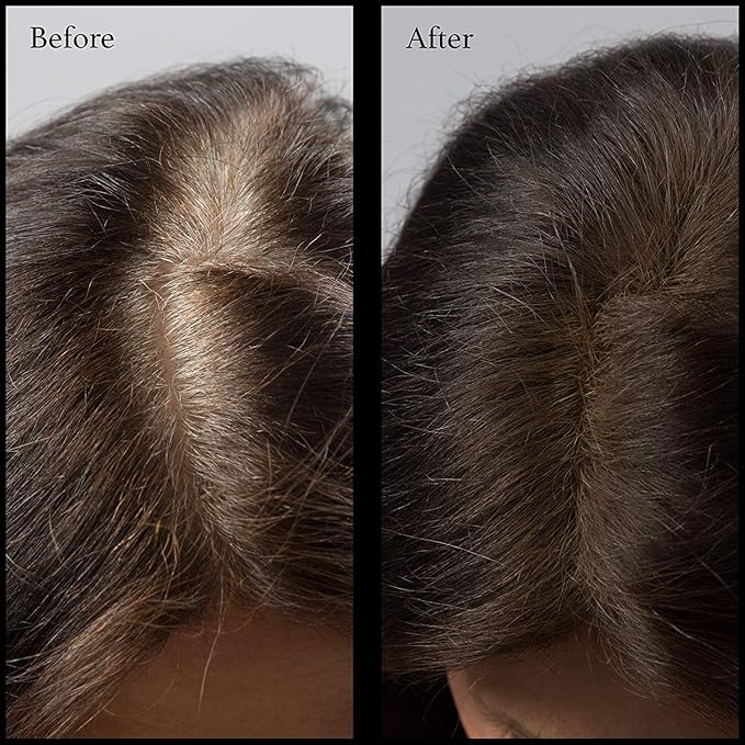 Root Touch Up Powder - True-to-Nature Hairline Concealer with 11 Shades - Fragrance-Free, Talc-Free, Paraben-Free (With Brush, Dark Brown)