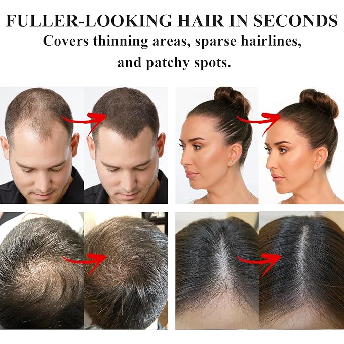 VOLLUCK Root Touch up Powder, Instant Hairline Powder for Thinning Areas and Gray Hair Coverage, Natural and Non-greasy Root Cover up for Women and Men (Dark Blonde, 0.35 Ounce)