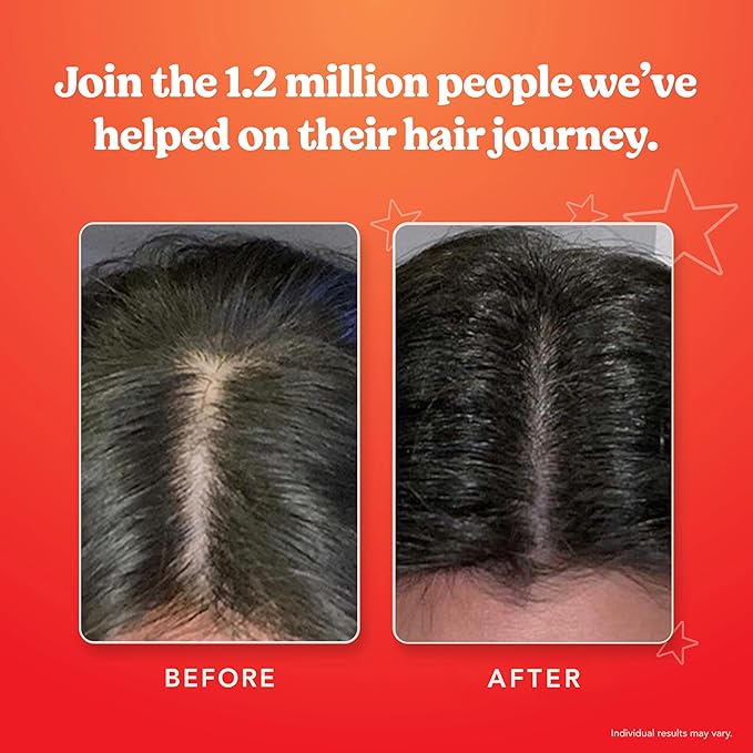 HAIRtamin Scalp Serum | Visibly Thicker, Nourished Hair and Healthy Scalp Treatment (Two Pack)