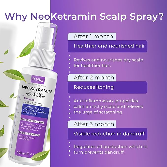 Neoketramin Anti Fungal Scalp Spray | Dandruff Treatment for Dandruff, Psoriasis & Folliculitis | Antifungal & Itchy Scalp Treatment for Dry, Irritated Scalp | Relief for Yeast Infections & Ringworm