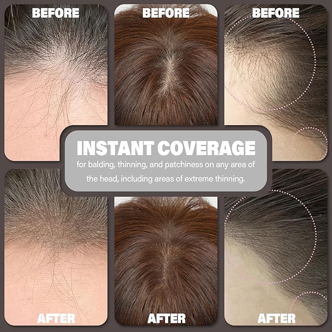 Root Touch Up Hair Color Powder For Concealing Hair Loss and Thinning, Gray Hair Shadow Powder Root Cover Up Hairline Powder For Women Men Eyebrows, Beard Line (Dark Brown, 0.35 Ounce)