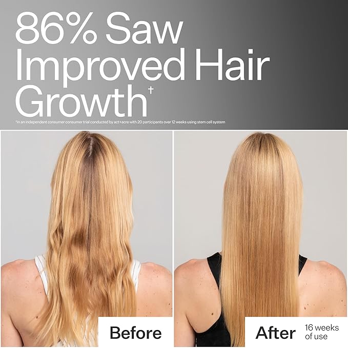 ACT+ ACRE Stem Cell Conditioner | Strengthens Ends, Adds Shine, Hydrates Fine Hair | Apple Stem Cells, Castor Oil, Antioxidants | Lightweight, Vegan, Cold Processed®, Color Safe | 10 Fl Oz