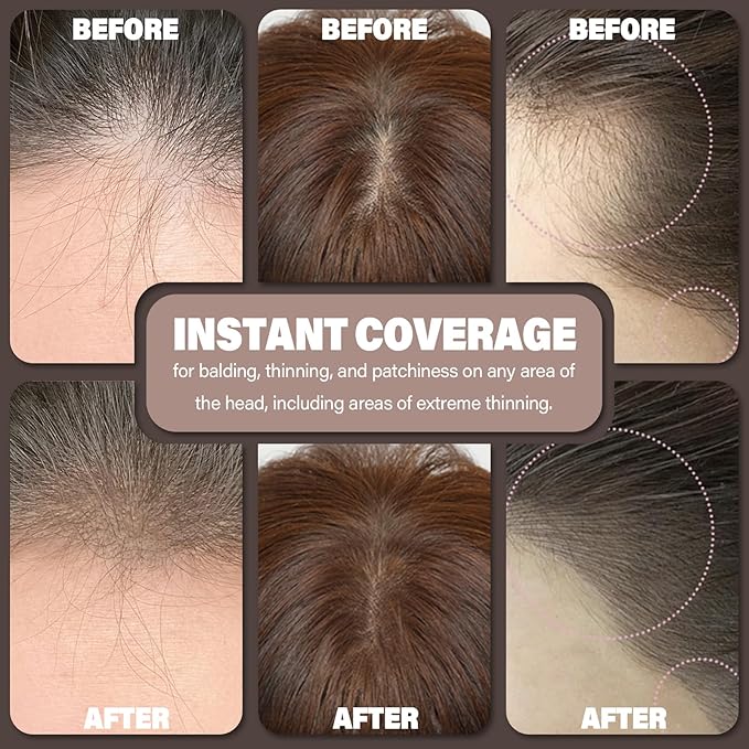 Root touch up hair color powder-Instantly Conceals Hair Loss and Thinning, Gray hair Cover Up Powder, hairline Powder Toppers and Fibers for Men & Women (Medium Brown, 0.35 ounce)