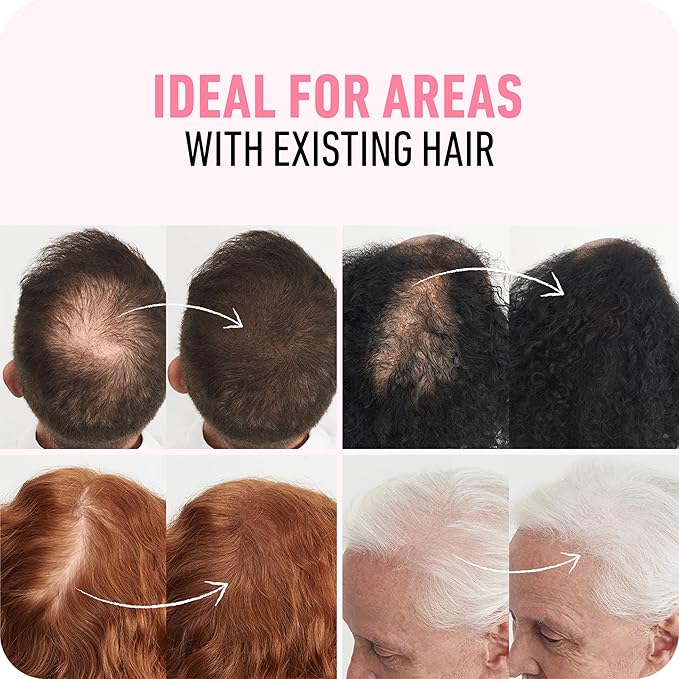 BOLDIFY Hair Fibers (28g) - Fill In Thinning and Fine Hair for an Instantly Fuller, Thicker Look - 14 Shades for Women & Men - Hazel Brown