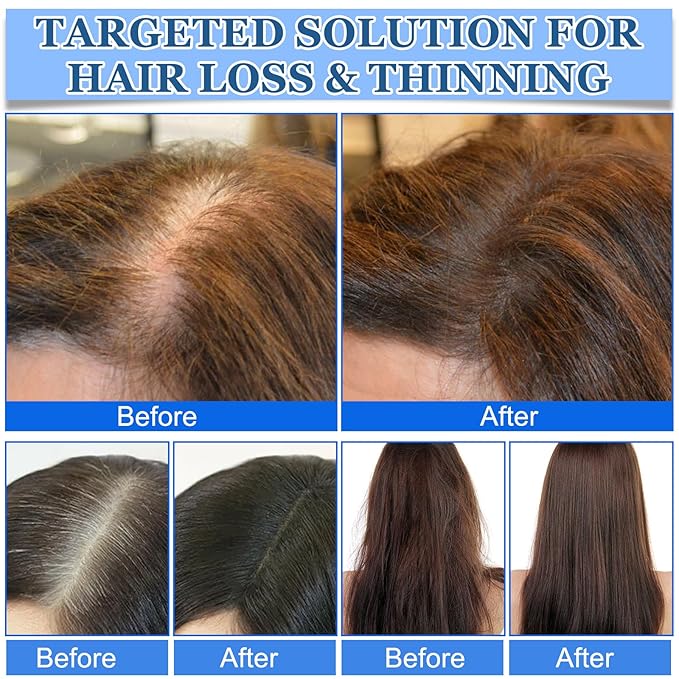 3Pcs Advanced Hair Growth Roll-On Serum, Promotes Growth, Reduces Hair Loss, Nourishes Scalp & Roots with Vitamin E & Natural Oils, For All Hair, Women & Men