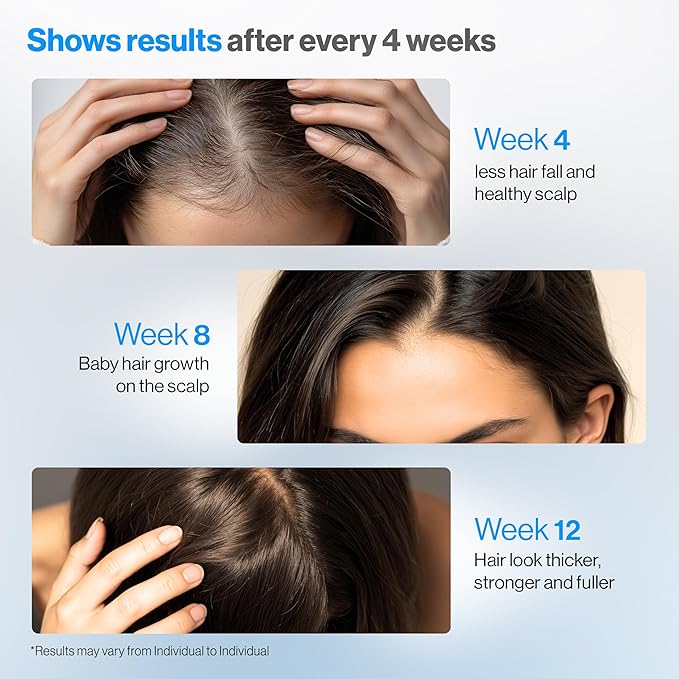 Be Bodywise Rosemary Hair Growth Serum Roll On 50 ml – 3% Rosemary, 3% Redensyl & 2% Anagain | DHT-Blocking Scalp Serum Boosts Oxygen Flow, Reduces Hair Fall | Paraben/Sulfate-Free | Women & Men